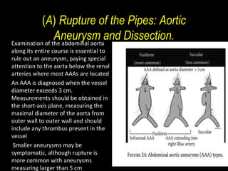 emergency echo in critically ill patients.ppt