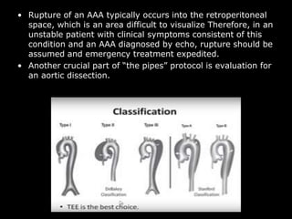 emergency echo in critically ill patients.ppt