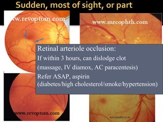 Retinal arteriole occlusion:
If within 3 hours, can dislodge clot
(massage, IV diamox, AC paracentesis)
Refer ASAP, aspirin
(diabetes/high cholesterol/smoke/hypertension)
 