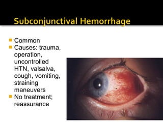  Common
 Causes: trauma,
operation,
uncontrolled
HTN, valsalva,
cough, vomiting,
straining
maneuvers
 No treatment;
reassurance
 
