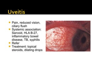  Pain, reduced vision,
ciliary flush
 Systemic association:
Sarcoid, HLA B-27,
inflammatory bowel
disease, TB, syphilis
 Refer
 Treatment: topical
steroids, dilating drops
 