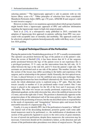 7 Perforated Gastroduodenal Ulcer 85
selecting patients.” “The laparoscopic approach is safe in patients with no risk
factors (Boey score D 0).” “Other principles of selection have been considered:
Mannheim Peritonitis Index (MPI), age >70 years, APACHE II and surgeon’s skill
in mini-invasive surgery.”
However, to date, there is no unanimous agreement about which group of patients
might beneﬁt from a laparoscopic approach of PPU and sufﬁcient information
regarding the laparoscopic repair in high-risk surgical patients.
Teoh et al. [34], in a retrospective study published in 2015, concluded the
adoption of laparoscopy-ﬁrst approach in patients suffering from PPU was asso-
ciated with acceptable rates of mortality and morbidity. The approach could also
be selectively adopted in patients hemodynamically stable with Boey score 2 and
low ASA grading.
7.4 Surgical Technique/Closure of the Perforation
Placing the patient in the Trendelenburg position at 15–20ı
is usually recommended.
The operator can position between the legs of the patient or at the patient’s side.
From the review of Bertleff [20], it has been shown that 44 % of the surgeons
prefer positioned between the legs of the patient (even in our experience this is
a privileged position), 33 % carry out the intervention from the left side, 16 %
either between the legs or the side left, and 6 % from the patient’s right side. The
assistants are positioned each at one side of the patient. The number, location, and
the section of the trocars may differ according to the habits and experience of the
surgeon, and in relationship to the patient’s build. Generally, the ﬁrst optical trocar,
12 mm, is placed between or over the umbilical area using open technique. Once
the pneumoperitoneum has been insufﬂated (alternatively the Verres needle can be
used), the whole abdominal cavity is explored using a 30ı
optic. Then the other
trocars (usually in number of 3) are positioned under visual control. One 5 mm
trocar is placed in the epigastric for the lift of the liver and if necessary of the
gallbladder. The other two trocars are usually positioned, respectively, in the left
abdominal quadrant, on the mild-clavicular line, above the umbilical transverse line
(12 mm), and on the right side (5 mm). The position is diametrically opposite on the
projection plane of the abdominal wall of the trans-pyloric region. There are other
variations in the positioning of trocars, but the one described seems to respond better
to the needs of ergonomics and “triangulation” between optics and trocars for the
uneventful outcome of a laparoscopy (Fig. 7.3).
Usually, it is easy to identify PPU, but if the perforation is located in a “difﬁcult”
site (lateral wall of the descending duodenum, posterior gastric wall) some addi-
tional maneuvers need to be performed, i.e., the mobilization of duodenum or the
section of the gastrocolic ligament to access to the retro-cavity of great omentum.
In case of missed site perforation, despite these maneuvers, the conversion may be
necessary. Conversion should not be considered a failure, as the detection and safe
closure of the perforation takes precedence over choice of surgical access. The gain
 