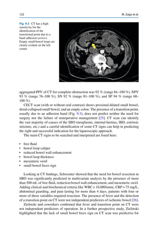 122 M. Zago et al.
Fig. 9.3 CT has a high
sensitivity for the
identiﬁcation of the
transitional point due to a
band adhesion (arrow).
Empty small bowel loops are
clearly evident on the left
corner
aggregated PPV of CT for complete obstruction was 92 % (range 84–100 %), NPV
93 % (range 76–100 %), SN 92 % (range 81–100 %), and SP 94 % (range 68–
100 %).
CECT scan (with or without oral contrast) shows proximal dilated small bowel,
distal collapsed small bowel, and an empty colon. The presence of a transition point,
usually due to an adhesion band (Fig. 9.3), does not predict neither the need for
surgery nor the failure of nonoperative management [25]. CT scan can identify
the vast majority of causes of the SBO (neoplasms, internal hernias, IBD, estrinsic
stricture, etc.) and a careful identiﬁcation of some CT signs can help in predicting
the right and successful indication for the laparoscopic approach.
The main CT signs to be searched and interpreted are listed here:
• free ﬂuid
• bowel loop caliper
• reduced bowel wall enhancement
• bowel loop thickness
• mesenteric swirl
• small bowel feces sign
Looking at CT ﬁndings, Schwenter showed that the need for bowel resection in
SBO was signiﬁcantly predicted in multivariate analysis by the presence of more
than 500 mL of free ﬂuid, reduction bowel wall enhancement, and mesenteric swirl.
Adding clinical and biochemical criteria like WBC > 10,000/mmc, CRP > 75 mg/L,
abdominal guarding, and pain lasting for more than 4 days, patients with four or
more of these variables required resection. The presence of fever and the detection
of a transition point on CT were not independent predictors of ischemic bowel [26].
Zielinski and coworkers conﬁrmed that fever and transition point on CT were
not independent predictors of operation. In a further prospective study, Zielinski
highlighted that the lack of small bowel feces sign on CT scan was predictive for
 