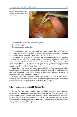 9 Laparoscopy in Small Bowel Obstruction 127
Fig. 9.5 Intraoperative view.
Single band adhesion cut with
cold scissors
– Operation after more than 24 h from diagnosis
– Duration of surgery
– Dense and extensive adhesions
Previous appendectomy was statistically associated with a higher rate of success-
ful laparoscopic management, with the single band adhesion as the ideal condition
for the laparoscopic approach [54–61, 66] (LoE 3) (Fig. 9.5).
The authors, in a retrospective study over 100 consecutive patients [59], reported
a conversion rate of 34.2 % and found as statistically signiﬁcant factor for
conversion a small bowel caliper >4 cm. Notwithstanding, the analysis of the
series revealed that 17.5 % of successful laparoscopic operations were performed
in patients with bowel loops larger than 4 cm.
Reduced port and single-port laparoscopic adhesiolysis has been reported, but
experiences are limited and only feasibility could be assessed. It is of interest to
note that preoperative imaging identifying a single band adhesion is deemed a
prerequisite for some authors [67] (LoE 4).
In pediatric patients, experience on the laparoscopic treatment of SBO is very
limited. Recent literature shows a trend in considering laparoscopy the ﬁrst option
for adhesive small bowel obstruction in children [68, 69] (LoE 4).
9.5.4 Laparoscopy in the SBO Algorithm
In the last few years, many articles were published suggesting comprehensive
algorithms for SBO management, including paths for nonoperative management,
water-soluble contrast administration, timing for expectant management, and crite-
ria for immediate or delayed surgery [35, 36, 62, 63, 70]. This chapter is speciﬁcally
devoted to the role of laparoscopy in SBO, and a careful analysis and comparison
among them is mandatorily skipped.
 
