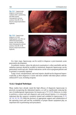 164 S. Di Saverio et al.
Fig. 12.1 Laparoscopic
diagnosis of peritoneal
violation after a penetrating
left ﬂank trauma
(intraoperative picture
courtesy from Dr. S. Di
Saverio surgical procedures
logbook)
Fig. 12.2 Laparoscopic
diagnosis of a left
diaphragmatic tear after an
abdominal penetrating
trauma, note the thoracic
drain (intraoperative picture
courtesy from Dr. S. Di
Saverio surgical procedures
logbook)
In a later stage, laparoscopy can be useful to diagnose a post-traumatic acute
pancreatitis development.
In pediatric trauma, where the physical examination is often unreliable and the
radiation exposure should be avoided or minimized, diagnostic laparoscopy can be
particularly useful and safe. Similar indications can be seen in pregnant patients and
in geriatric or mentally impaired.
Large vessel, retroperitoneal, and renal injuries should not be diagnosed laparo-
scopically as their diagnosis is easier and more reliable with three-phase contrast-
enhanced CT scan, including urogram.
12.2.2 Surgical Technique
Many studies have already stated the high efﬁcacy of diagnostic laparoscopy in
precisely recognizing the abdominal injuries, as well as signiﬁcantly reducing the
rate of nontherapeutic laparotomies for trauma up to 73 % [15]. However, in order
to perform a correct and safe diagnosis and avoid missed injuries, it is extremely
important that the surgeon is properly trained and conﬁdent in laparoscopy [7, 9,
10, 18, 19, 24, 25]. Both the presence of appropriate support and collaboration of
the operating room staff and the availability of proper theater equipment play an
important role in performing such procedures.
 