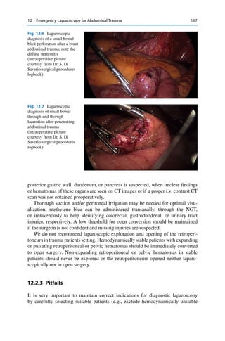 12 Emergency Laparoscopy for Abdominal Trauma 167
Fig. 12.6 Laparoscopic
diagnosis of a small bowel
blast perforation after a blunt
abdominal trauma; note the
diffuse peritonitis
(intraoperative picture
courtesy from Dr. S. Di
Saverio surgical procedures
logbook)
Fig. 12.7 Laparoscopic
diagnosis of small bowel
through-and-thorugh
laceration after penetrating
abdominal trauma
(intraoperative picture
courtesy from Dr. S. Di
Saverio surgical procedures
logbook)
posterior gastric wall, duodenum, or pancreas is suspected, when unclear ﬁndings
or hematomas of these organs are seen on CT images or if a proper i.v. contrast CT
scan was not obtained preoperatively.
Thorough suction and/or peritoneal irrigation may be needed for optimal visu-
alization; methylene blue can be administered transanally, through the NGT,
or intravenously to help identifying colorectal, gastroduodenal, or urinary tract
injuries, respectively. A low threshold for open conversion should be maintained
if the surgeon is not conﬁdent and missing injuries are suspected.
We do not recommend laparoscopic exploration and opening of the retroperi-
toneum in trauma patients setting. Hemodynamically stable patients with expanding
or pulsating retroperitoneal or pelvic hematomas should be immediately converted
to open surgery. Non-expanding retroperitoneal or pelvic hematomas in stable
patients should never be explored or the retroperitoneum opened neither laparo-
scopically nor in open surgery.
12.2.3 Pitfalls
It is very important to maintain correct indications for diagnostic laparoscopy
by carefully selecting suitable patients (e.g., exclude hemodynamically unstable
 