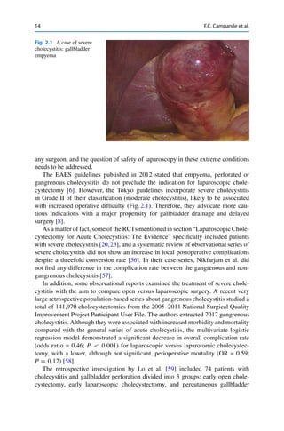 14 F.C. Campanile et al.
Fig. 2.1 A case of severe
cholecystitis: gallbladder
empyema
any surgeon, and the question of safety of laparoscopy in these extreme conditions
needs to be addressed.
The EAES guidelines published in 2012 stated that empyema, perforated or
gangrenous cholecystitis do not preclude the indication for laparoscopic chole-
cystectomy [6]. However, the Tokyo guidelines incorporate severe cholecystitis
in Grade II of their classiﬁcation (moderate cholecystitis), likely to be associated
with increased operative difﬁculty (Fig. 2.1). Therefore, they advocate more cau-
tious indications with a major propensity for gallbladder drainage and delayed
surgery [8].
As a matter of fact, some of the RCTs mentioned in section “Laparoscopic Chole-
cystectomy for Acute Cholecystitis: The Evidence” speciﬁcally included patients
with severe cholecystitis [20,23], and a systematic review of observational series of
severe cholecystitis did not show an increase in local postoperative complications
despite a threefold conversion rate [56]. In their case-series, Nikfarjam et al. did
not ﬁnd any difference in the complication rate between the gangrenous and non-
gangrenous cholecystitis [57].
In addition, some observational reports examined the treatment of severe chole-
cystitis with the aim to compare open versus laparoscopic surgery. A recent very
large retrospective population-based series about gangrenous cholecystitis studied a
total of 141,970 cholecystectomies from the 2005–2011 National Surgical Quality
Improvement Project Participant User File. The authors extracted 7017 gangrenous
cholecystitis. Although they were associated with increased morbidity and mortality
compared with the general series of acute cholecystitis, the multivariate logistic
regression model demonstrated a signiﬁcant decrease in overall complication rate
(odds ratio = 0.46; P < 0:001) for laparoscopic versus laparotomic cholecystec-
tomy, with a lower, although not signiﬁcant, perioperative mortality (OR = 0.59;
P D 0:12) [58].
The retrospective investigation by Lo et al. [59] included 74 patients with
cholecystitis and gallbladder perforation divided into 3 groups: early open chole-
cystectomy, early laparoscopic cholecystectomy, and percutaneous gallbladder
 