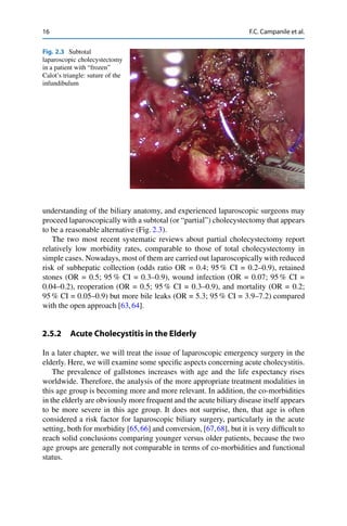 16 F.C. Campanile et al.
Fig. 2.3 Subtotal
laparoscopic cholecystectomy
in a patient with “frozen”
Calot’s triangle: suture of the
infundibulum
understanding of the biliary anatomy, and experienced laparoscopic surgeons may
proceed laparoscopically with a subtotal (or “partial”) cholecystectomy that appears
to be a reasonable alternative (Fig. 2.3).
The two most recent systematic reviews about partial cholecystectomy report
relatively low morbidity rates, comparable to those of total cholecystectomy in
simple cases. Nowadays, most of them are carried out laparoscopically with reduced
risk of subhepatic collection (odds ratio OR = 0.4; 95 % CI = 0.2–0.9), retained
stones (OR = 0.5; 95 % CI = 0.3–0.9), wound infection (OR = 0.07; 95 % CI =
0.04–0.2), reoperation (OR = 0.5; 95 % CI = 0.3–0.9), and mortality (OR = 0.2;
95 % CI = 0.05–0.9) but more bile leaks (OR = 5.3; 95 % CI = 3.9–7.2) compared
with the open approach [63,64].
2.5.2 Acute Cholecystitis in the Elderly
In a later chapter, we will treat the issue of laparoscopic emergency surgery in the
elderly. Here, we will examine some speciﬁc aspects concerning acute cholecystitis.
The prevalence of gallstones increases with age and the life expectancy rises
worldwide. Therefore, the analysis of the more appropriate treatment modalities in
this age group is becoming more and more relevant. In addition, the co-morbidities
in the elderly are obviously more frequent and the acute biliary disease itself appears
to be more severe in this age group. It does not surprise, then, that age is often
considered a risk factor for laparoscopic biliary surgery, particularly in the acute
setting, both for morbidity [65,66] and conversion, [67,68], but it is very difﬁcult to
reach solid conclusions comparing younger versus older patients, because the two
age groups are generally not comparable in terms of co-morbidities and functional
status.
 