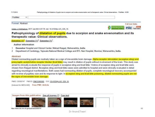 Amoxicillin cost walmart