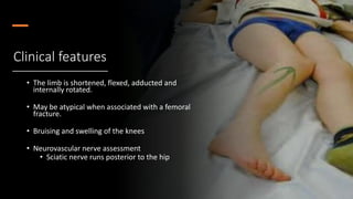 Emergency management of common dislocations | PPTX