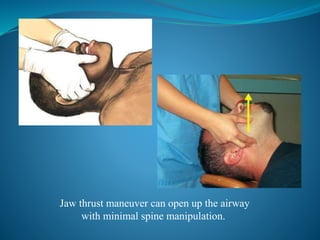 Emergency management of patients with facial trauma | PPTX