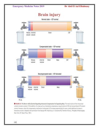 Emergency Medicine Notes 2019 Dr Abd El Aal Elbahnasy
192
Brain injury
 