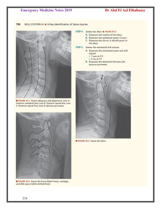 Emergency Medicine Notes 2019 Dr Abd El Aal Elbahnasy
216
 