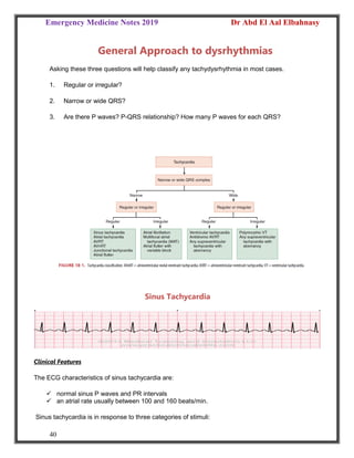 Emergency Medicine Notes 2019 Dr Abd El Aal Elbahnasy
40
General Approach to dysrhythmias
Asking these three questions will help classify any tachydysrhythmia in most cases.
1. Regular or irregular?
2. Narrow or wide QRS?
3. Are there P waves? P-QRS relationship? How many P waves for each QRS?
Sinus Tachycardia
Clinical Features
The ECG characteristics of sinus tachycardia are:
 normal sinus P waves and PR intervals
 an atrial rate usually between 100 and 160 beats/min.
Sinus tachycardia is in response to three categories of stimuli:
 