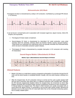 Emergency Medicine Notes 2019 Dr Abd El Aal Elbahnasy
49
Atrioventricular (AV) Block
First-degree AV block is characterized by a delay in AV conduction, manifested by a prolonged PR interval
(> 0.2 second).
It can be found in normal hearts and in association with increased vagal tone, digoxin toxicity, inferior MI,
amyloid, and myocarditis.
 First-degree AV block needs no treatment.
 Second-degree AV block is characterized by intermittent AV nodal conduction: some atrial
impulses reach the ventricles, whereas others are blocked, thereby causing “grouped beating.”
These blocks can subdivided into nodal blocks which are typically reversible and infranodal blocks
which are due to irreversible conduction system disease.
 Third-degree AV block is characterized by complete interruption in AV conduction with resulting
AV dissociation.
Second-Degree Mobitz I (Wenckebach) AV Block
Clinical Features
 Mobitz I AV block is a nodal block causing a progressive prolongation of conduction through the AV
node until the atrial impulse is completely blocked. Usually, only one atrial impulse is blocked at a
time.
 After the dropped beat, the AV conduction returns to normal and the cycle usually repeats itself
with the same conduction ratio (fixed ratio) or a different conduction ratio (variable ratio). Although
the PR intervals progressively lengthen before the dropped beat, the increments by which they
lengthen decrease with successive beats causing a progressive shortening of each successive R–
R interval before the dropped beat .This block is often transient and usually associated with an
acute inferior MI, digoxin toxicity, or myocarditis or can be seen after cardiac surgery. Because the
blockade occurs at the level of the AV node itself rather than at the infranodal conducting system,
this is usually a stable rhythm
 