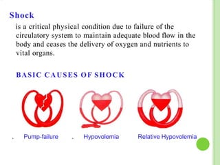 Shock
is a critical physical condition due to failure of the
circulatory system to maintain adequate blood flow in the
body and ceases the delivery of oxygen and nutrients to
vital organs.
BASIC CAUSES OF SHOCK
. Pump-failure Relative Hypovolemia
. Hypovolemia
 