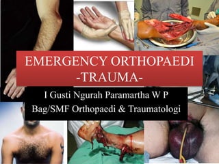 EMERGENCY ORTHOPAEDI
-TRAUMA-
I Gusti Ngurah Paramartha W P
Bag/SMF Orthopaedi & Traumatologi
 