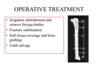 OPERATIVE TREATMENT
• Irrigation, debridement and
remove foreign bodies
• Fracture stabilization
• Soft tissue coverage and bone
grafting
• Limb salvage
 