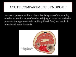 ACUTE COMPARTMENT SYNDROME
Increased pressure within a closed fascial spaces of the arm, leg
or other extremity, most often due to injury, exceeds the perfusion
pressure (enough to occlude capillary blood flow) and results in
muscle and nerve ischemia.
 