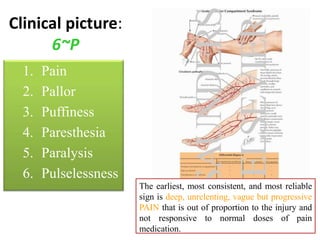 Clinical picture:
6~P
1. Pain
2. Pallor
3. Puffiness
4. Paresthesia
5. Paralysis
6. Pulselessness
The earliest, most consistent, and most reliable
sign is deep, unrelenting, vague but progressive
PAIN that is out of proportion to the injury and
not responsive to normal doses of pain
medication.
 