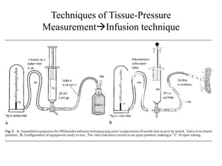 Techniques of Tissue-Pressure
MeasurementInfusion technique
 