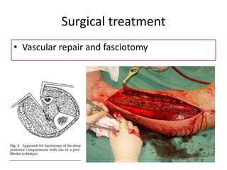 Surgical treatment
• Vascular repair and fasciotomy
 