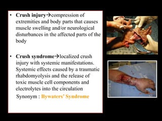 • Crush injurycompression of
extremities and body parts that causes
muscle swelling and/or neurological
disturbances in the affected parts of the
body
• Crush syndromelocalized crush
injury with systemic manifestations.
Systemic effects caused by a traumatic
rhabdomyolysis and the release of
toxic muscle cell components and
electrolytes into the circulation
Synonym : Bywaters’ Syndrome
 