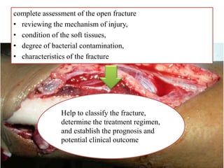 complete assessment of the open fracture
• reviewing the mechanism of injury,
• condition of the soft tissues,
• degree of bacterial contamination,
• characteristics of the fracture
Help to classify the fracture,
determine the treatment regimen,
and establish the prognosis and
potential clinical outcome
 