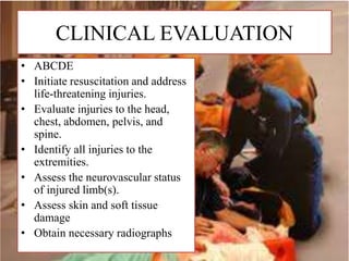 CLINICAL EVALUATION
• ABCDE
• Initiate resuscitation and address
life-threatening injuries.
• Evaluate injuries to the head,
chest, abdomen, pelvis, and
spine.
• Identify all injuries to the
extremities.
• Assess the neurovascular status
of injured limb(s).
• Assess skin and soft tissue
damage
• Obtain necessary radiographs
 
