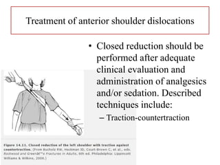 Treatment of anterior shoulder dislocations
• Closed reduction should be
performed after adequate
clinical evaluation and
administration of analgesics
and/or sedation. Described
techniques include:
– Traction-countertraction
 