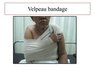 Velpeau bandage
 