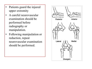 • Patients guard the injured
upper extremity
• A careful neurovascular
examination should be
performed before
radiography or
manipulation.
• Following manipulation or
reduction, repeat
neurovascular examination
should be performed.
 