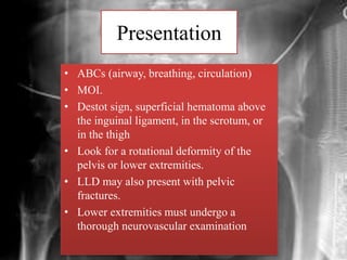 Presentation
• ABCs (airway, breathing, circulation)
• MOI.
• Destot sign, superficial hematoma above
the inguinal ligament, in the scrotum, or
in the thigh
• Look for a rotational deformity of the
pelvis or lower extremities.
• LLD may also present with pelvic
fractures.
• Lower extremities must undergo a
thorough neurovascular examination
 
