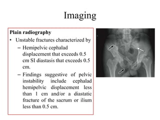 Imaging
Plain radiography
• Unstable fractures characterized by
– Hemipelvic cephalad
displacement that exceeds 0.5
cm SI diastasis that exceeds 0.5
cm.
– Findings suggestive of pelvic
instability include cephalad
hemipelvic displacement less
than 1 cm and/or a diastatic
fracture of the sacrum or ilium
less than 0.5 cm.
 