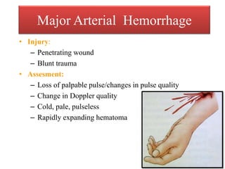 Major Arterial Hemorrhage
• Injury:
– Penetrating wound
– Blunt trauma
• Assesment:
– Loss of palpable pulse/changes in pulse quality
– Change in Doppler quality
– Cold, pale, pulseless
– Rapidly expanding hematoma
 
