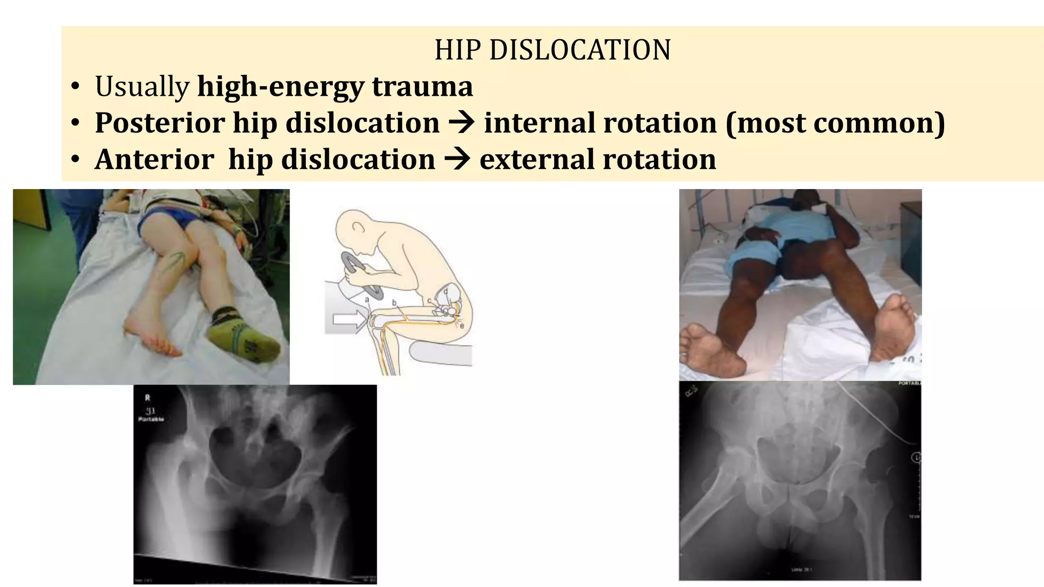 emergency ortopedi .pptx