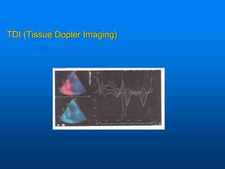 TDI (Tissue Dopler Imaging)
 