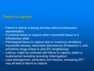 Failure to capture
• Failure to deliver a pacing stimulus without subsequent
depolarisation
• Functional failure to capture when myocardial tissue is in
refractionary state
• Pathological failure to capture due to numerous conditions;
myocardial disease, electrolyte disturbances (Potassium !), anti-
arrhythmic drugs (Class Ic and QTc lengthening)
• Latency; might be confused with failure to capture; obtain a
multichannel recording recording (interrogation)
• Lead dislodgement, perforation and fracture, increasing DFT
may all lead to failure to capture
 