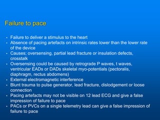 Failure to pace
• Failure to deliver a stimulus to the heart
• Absence of pacing artefacts on intrinsic rates lower than the lower rate
of the device
• Causes; oversensing, partial lead fracture or insulation defects,
crosstalk
• Oversensing could be caused by retrograde P waves, t waves,
ventricular EADs or DADs skeletal myo-potentials (pectoralis,
diaphragm, rectus abdomens)
• External electromagnetic interference
• Blunt trauma to pulse generator, lead fracture, dislodgement or loose
connection
• Pacing artefacts may not be visible on 12 lead ECG and give a false
impression of failure to pace
• PACs or PVCs on a single telemetry lead can give a false impression of
failure to pace
 