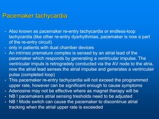 Pacemaker tachycardia
• Also known as pacemaker re-entry tachycardia or endless-loop
tachycardia (like other re-entry dysrhythmias, pacemaker is now a part
of the re-entry circuit)
• only in patients with dual chamber devices
• An intrinsic premature complex is sensed by an atrial lead of the
pacemaker which responds by generating a ventricular impulse. The
ventricular impuls is retrogradely conducted via the AV node to the atria,
now the atrial lead senses the atrial impulse and generates a ventriculair
pulse (completed loop)
• This pacemaker re-entry tachycardia will not exceed the programmed
upper rate, however can be significant enough to cause symptoms
• Adenosine may not be effective where as magnet therapy will be
• NB ! pacemakers atrial sensing tresholds need to be adjusted
• NB ! Mode switch can cause the pacemaker to discontinue atrial
tracking when the atrial upper rate is exceeded
 