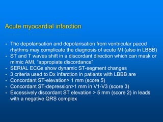 Acute myocardial infarction
• The depolarisation and depolarisation from ventricular paced
rhythms may complicate the diagnosis of acute MI (also in LBBB)
• ST and T waves shift in a discordant direction which can mask or
mimic AMI, “appropiate discordance”
• SERIAL ECGs show dynamic ST-segment changes
• 3 criteria used to Dx infarction in patients with LBBB are
• Concordant ST-elevation> 1 mm (score 5)
• Concordant ST-depression>1 mm in V1-V3 (score 3)
• Excessively discordant ST elevation > 5 mm (score 2) in leads
with a negative QRS complex
 