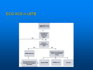 ECG ACS in LBTB
 