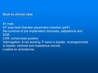 Back to clinical case
81 male
4/7 post dual chamber pacemaker insertion (pAF)
Re-currence of pre implantation dizziness, palpitations and
SOB
CXR: correct lead position
Interrogation: A not sensing, P wave in bipolar, re-programmed
to bipolar, treshold and impedence normal.
Loaded on amiodarone
 