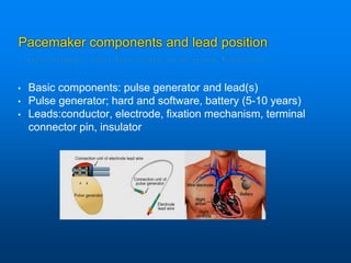 Pacemaker components and lead position
• Basic components: pulse generator and lead(s)
• Pulse generator; hard and software, battery (5-10 years)
• Leads:conductor, electrode, fixation mechanism, terminal
connector pin, insulator
 