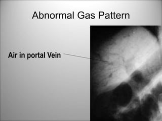Emergency Radiology in Surgery .ppt