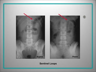 Emergency Radiology in Surgery .ppt
