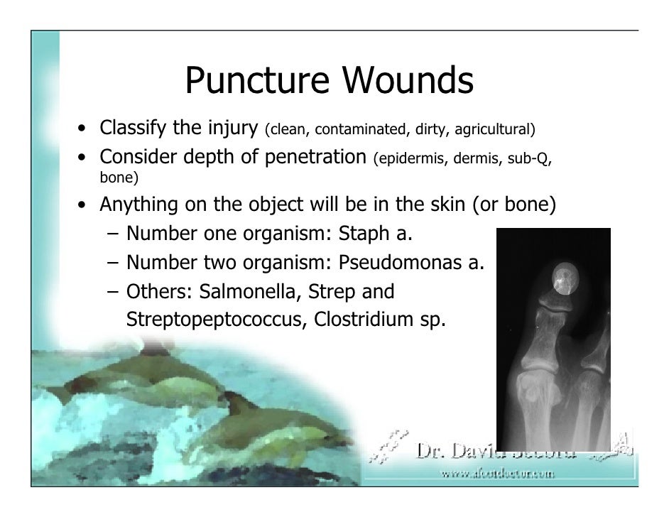 Emergency Room Notes