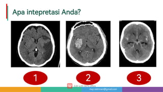 risqi.rakhman@gmail.com
ApaintepretasiAnda?
2
1 3
 