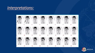 Interpretations:
 