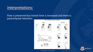 Interpretations:
Flow is preserved but transit time is increased and there is
parenchymal retention.
Renal Scintigraphy in the Acute Care Setting
 